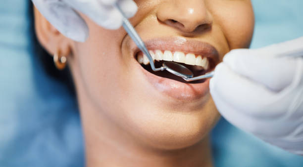 Best Broken or Chipped Tooth Repair in Dewey, OK